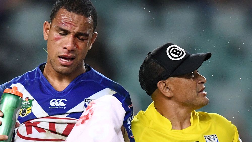 Hopoate plays Sundays in non-perfect world