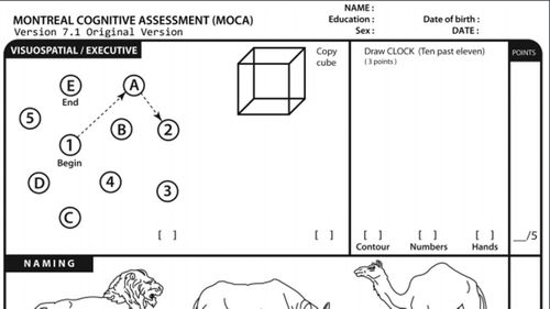 Part of the MoCA cognitive test. Photo: supplied