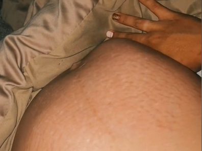 Misshapen pregnancy belly from a baby kicking
