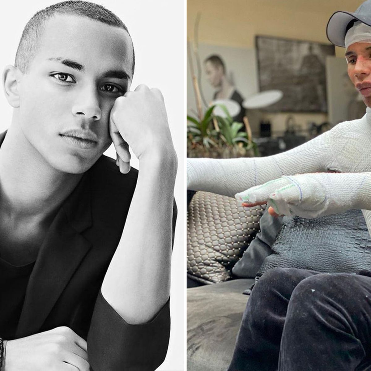 Olivier Rousteing shares details of fireplace explosion, says it inspired  his work at Balmain