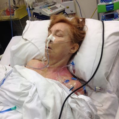 Sandie Foreman in intensive care after surgery to remove her lung.
