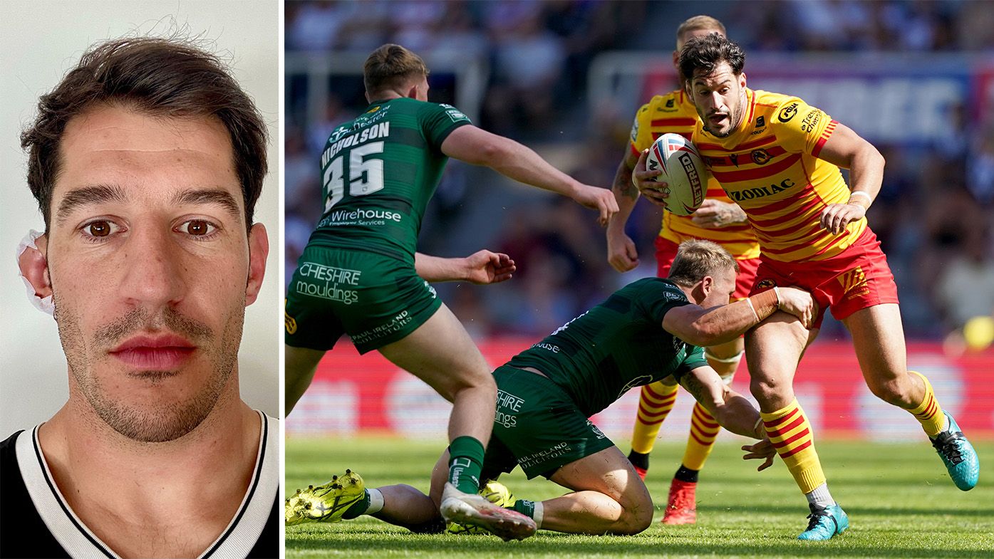 Catalans captain Ben Garcia had 20 stitches to re-attach his ear after a gruesome injury in their match against Warrington.