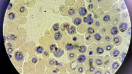 Queensland Health authorities are investigating two new locally-acquired cases of malaria.