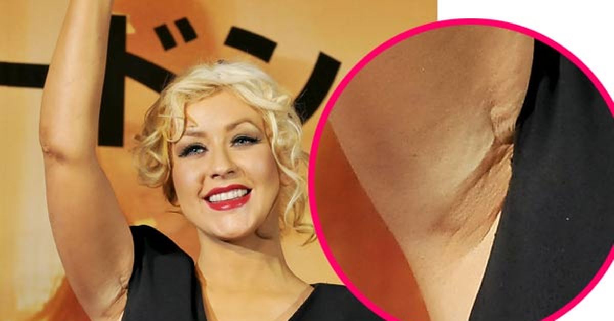 Christina Aguilera flashes "boob job scar"