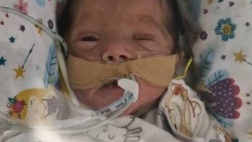When Chris Breen and his wife lost their baby when she was just six weeks old, they needed time to grieve.But while Breen, 55, was still able to take his planned three months of parental leave, his wife, who didn't want her name published, was forced back to work.