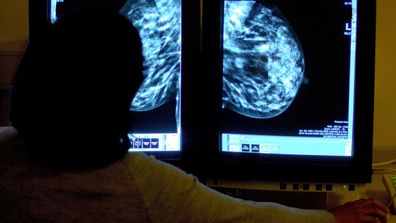 The errors date back to breast screenings in the UK as far as 2009.