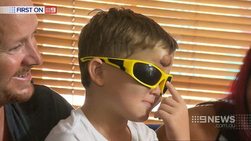 Ryan has asked his parents for sunglasses to hid his bruises. (9NEWS)