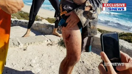 Mr Longrass said the shark left a tooth in his thigh. (9NEWS)