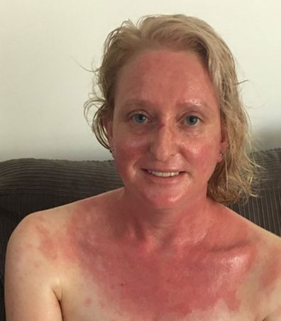 Belinda Shaw, a business development worker has a mystery allergy to multiple chemicals doctors simply don’t know how to treat.