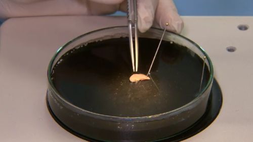 The innovative treatment utilises stem cells. (9NEWS)