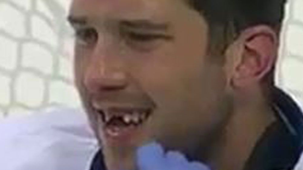 Ice hockey goalie loses his front teeth after puck hits his face