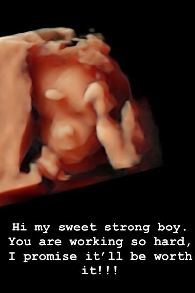 Chrissy Teigen shared a snap of her ultrasound.