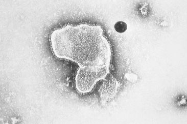 A human respiratory syncytial virus, also known as RSV.