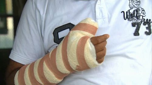 Nilesh Patel was slashed with a sword during the robbery. (9NEWS)