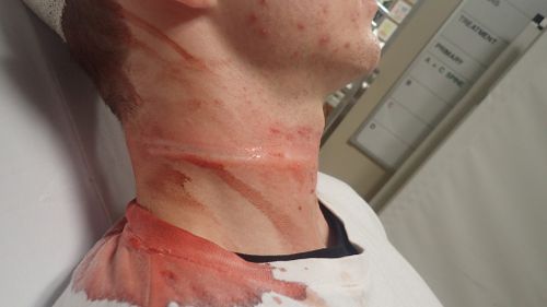 Boy, 12, charged over alleged involvement in 'clothesline' attack that injured Perth motorbike rider