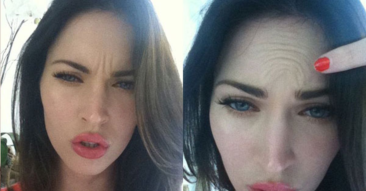 Меган после пластики. Меган Фокс ботокс. Меган Фокс пластика. Megan Fox до операции. Меган Фокс до пластической операции.