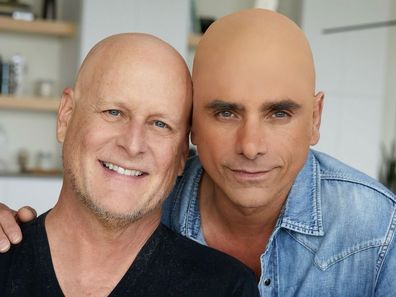 John Stamos wears bald cap in solidarity with Dave Coulier