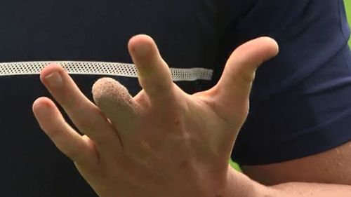 The four fingers that remain. (9NEWS)