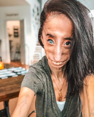 Lizzie Velasquez became an anti-bullying activist at 17 after a YouTube video called her the 'World's Ugliest Woman'.