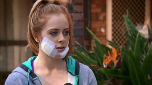 Young WA zookeeper facing surgery after dingo attack