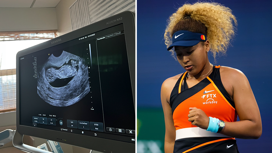 Former world No. 1 tennis player Naomi Osaka gives birth to girl, boyfriend Cordae reveals