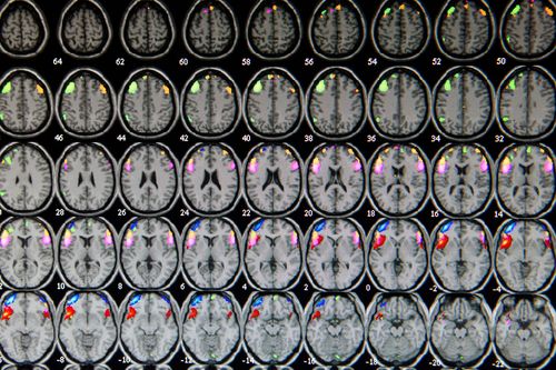 Brain scans captured by a medical imaging instrument.