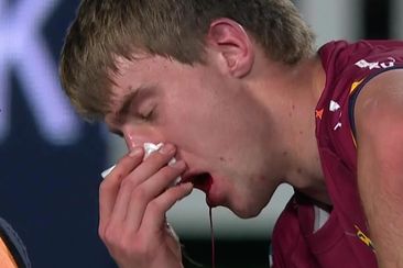 Blood pours from the mouth of Highlanders player Cameron Miller.