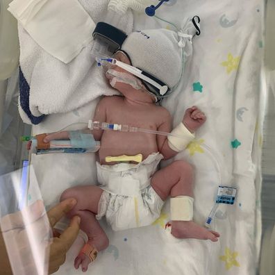 Lorenzo was born at 34 weeks and struggled to breathe as a newborn.