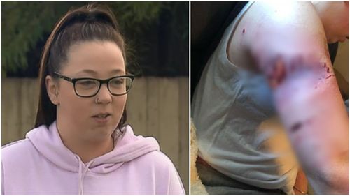 Ashley Harraghy, 20, was brutally attacked by two dogs in her own backyard. (9NEWS)