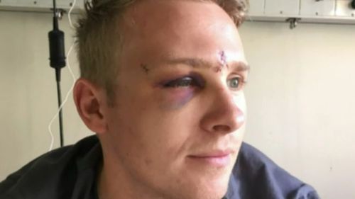 Daniel Yeoman was left with permanent scarring and nerve damage after the attack. (Supplied)