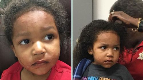 The Sheriff’s Department posted a photo of the older toddler to Facebook and asked for help identifying him or his parents