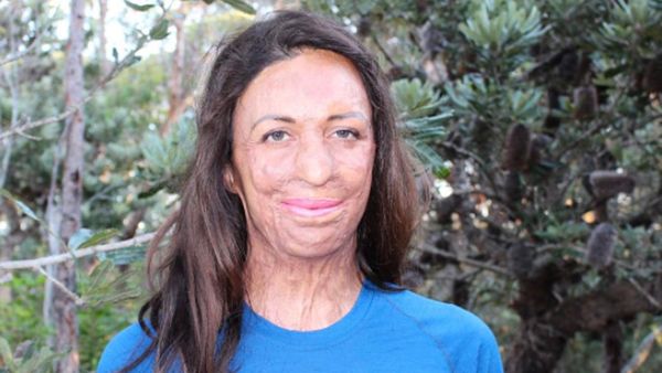 Turia Pitt (Instagram)