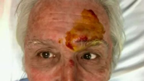 A bus driver was headbutted by a teenager on Saturday. (Supplied)