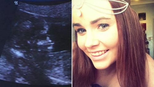 Pregnant teen drowns in bathtub after suffering epileptic fit