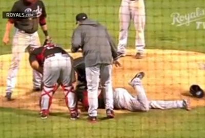<b>An American pitcher has suffered multiple facial fractures in a sickening incident in Major League Baseball.</b><br/><br/>Aroldis Chapman was in action for the Cincinatti Reds when he was struck in the face by a line drive from Kansas City Royals catcher Salvador Perez.<br/><br/>He broke bones in his nose and near his left eye.<br/><br/>Line drives, or comebackers, carry significant risks to pitchers who have almost no time to react. Chapman's is one of a spate of brutal blows we've seen in recent years.<br/><br/>