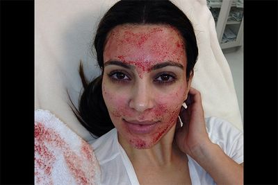 We didn't think it was possible to be any more shocked by what Kim K uploads to Instagram, but she sure proved us wrong when she decided to share this horrifying photo of herself after a blood facial — yuck! <br/><br/><i>Image: Instagram @kimkardashian</i>