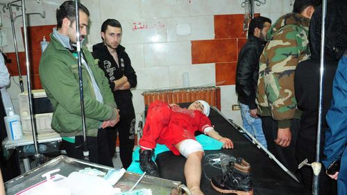 A handout photo made available by Syria's Arab News Agency (SANA) shows an injured child being treated in a government hospital in Jaramana City. (AAP)