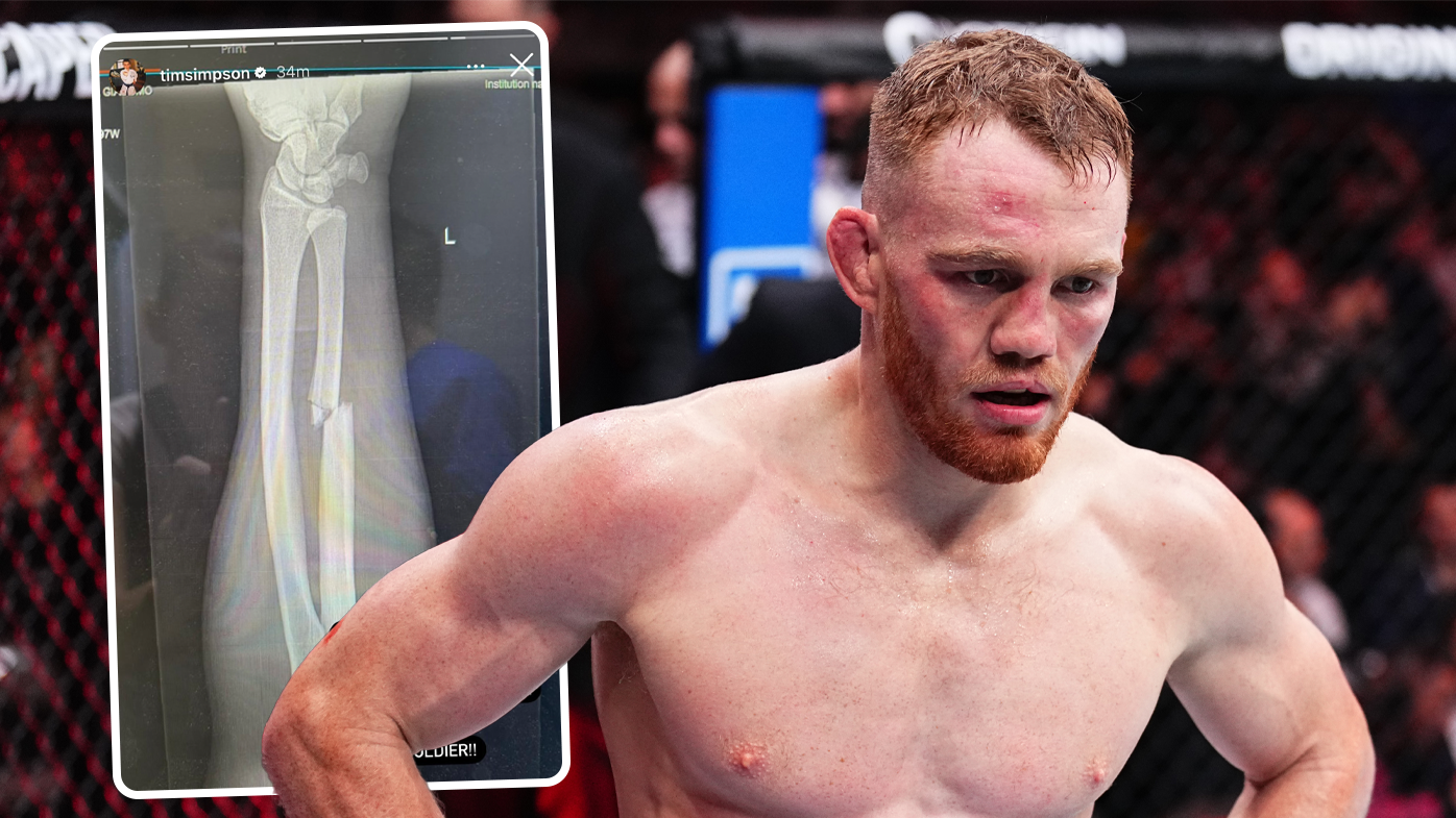 Shocking X-ray reveals full extent of Jack Della Maddalena's UFC 299 triumph