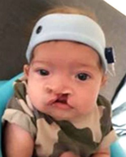 Jessica Beckman's son Ethan. Ms Beckman has started an online petition calling for subsidised speech pathology to be funded for children with cleft lip and or palate.