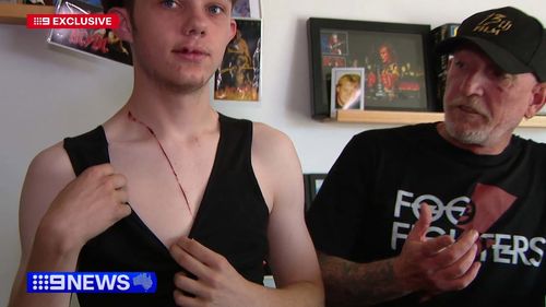 Espancado e machucado depois de uma pausa assustadora que explodiu em violência, Chris Abrook está feliz por ter resistido.