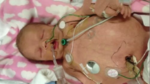 Aubree Lehner had both her kidneys removed within two weeks of her life. (9NEWS)