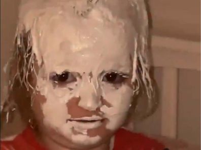 Child covered in Sudocrem.