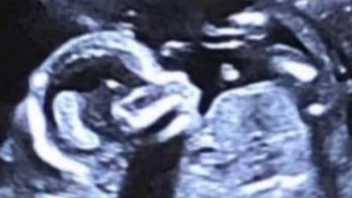 A $250,000 reward is being offered by police for anyone who can help police find accused murderer Julian Ingram. The 37-year-old has been on the run for almost two months, accused of the shooting deaths of his pregnant ex-partner Sophie Quinn, her aunty Nerida Quinn and her friend John Harris at Lake Cargelligo in the NSW Central West on January 22.