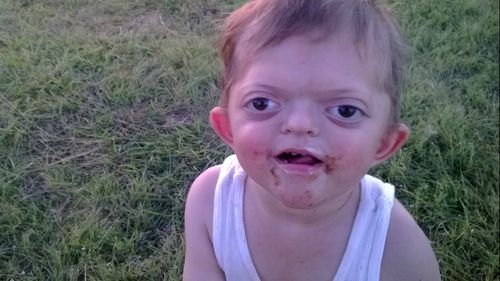 'He's not scary, he's just a little boy': Mother of child with genetic disorder pens heartfelt blog to fellow parents