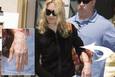 There's nothing unusual about a woman's hands going a bit wrinkly as she ages, but when her face doesn't follow suit, that's when it gets a bit weird. Madonna's hand to face wrinkle ratio has been freaking us out for about a decade now.