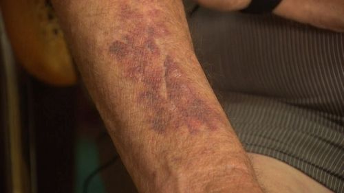The grandfather said he tried to put up a fight but was left bruised. (9NEWS)