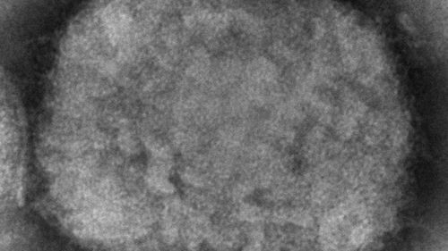 This 2003 electron microscope image made available by the Centers for Disease Control and Prevention shows a monkeypox virion, obtained from a sample associated with the 2003 prairie dog outbreak. Monkeypox, a disease that rarely appears outside Africa, has been identified by European and American health authorities in recent days. (Cynthia S. Goldsmith, Russell Regner/CDC via AP)