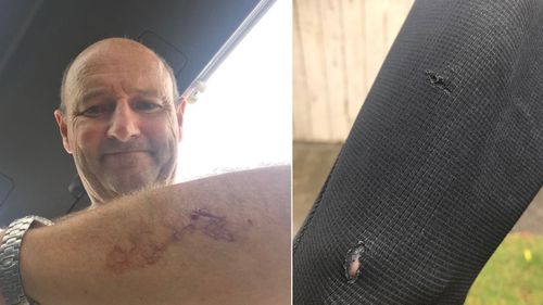 Nick Minogue was left with a deep cut on his left arm after a shark glanced his wetsuit.