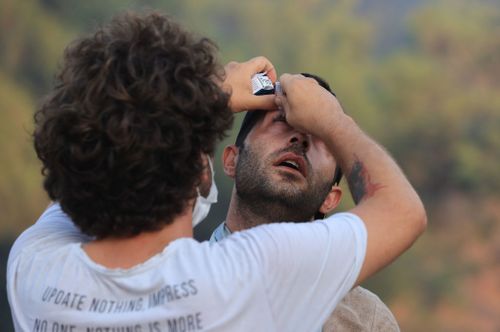 A man applies eye drop to a fire-affected man. Turkish authorities maintain their tireless efforts to contain forest fires that erupted in various parts of the country. (Photo by Mahmut Serdar Alakus/Anadolu Agency via Getty Images)