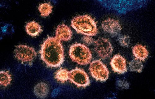 This electron microscope image shows SARS-CoV-2 virus particles which cause COVID-19.